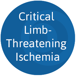 Critical Limb-Threatening Ischemia circle, blue